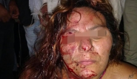 Recibi&oacute; atenci&oacute;n m&eacute;dica tras los severos golpes 