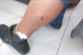 Mujer fue herida por una flecha en la 31 Poniente